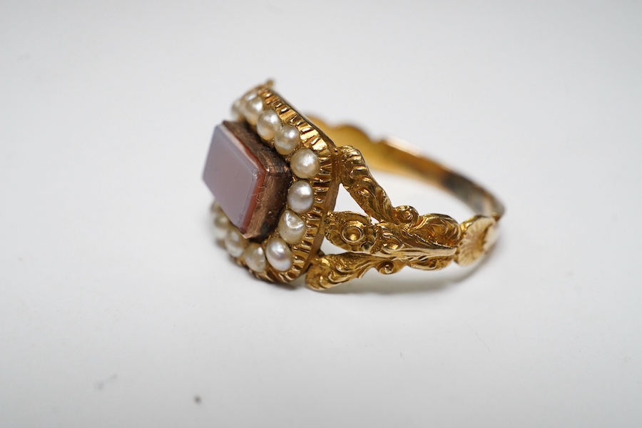 A Victorian yellow metal, carnelian and split pearl set ring, with carved split shoulders, size L, gross weight 2.7 grams. Condition - poor to fair